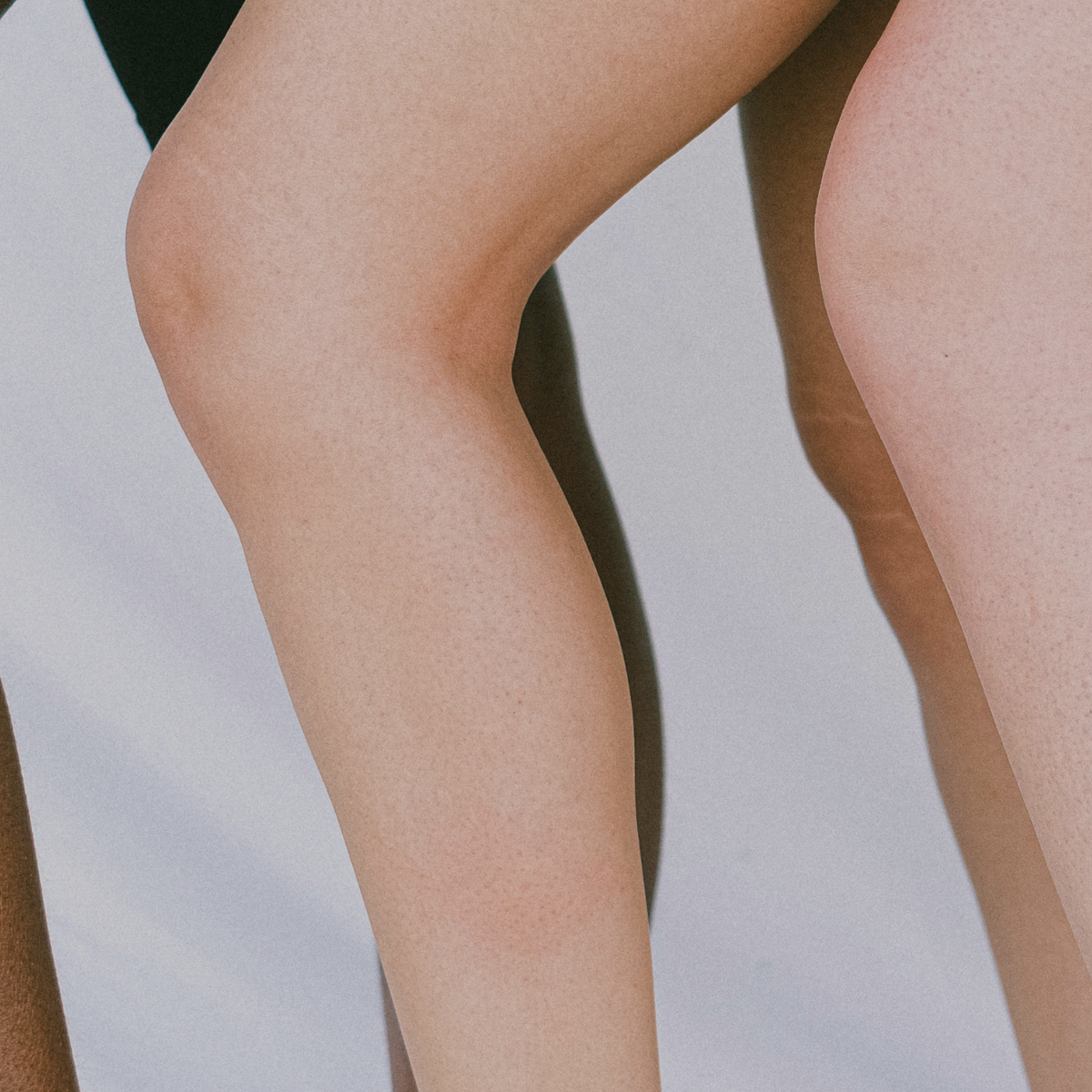 Vein Treatments