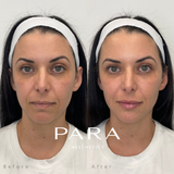 Advanced Facial Balancing